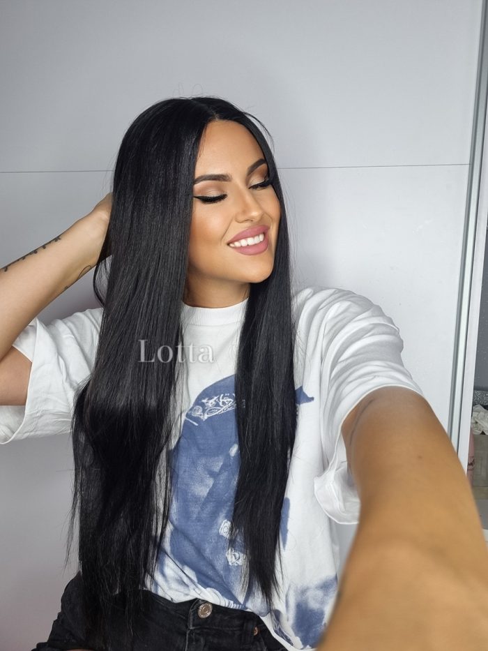 lotta PERIKE PERIKE S CIPKOM MREZICOM KIA 1 1660766606191